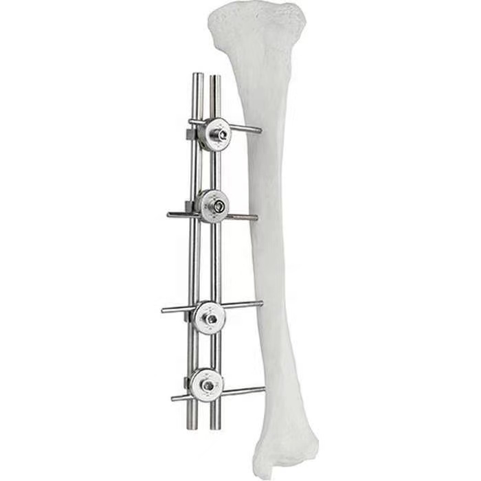 Guaranteed Quality Femur & Tibia External Fixator Surgical Implant